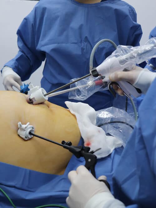 bariatric-surgery-cirugia-bariatrica (1)