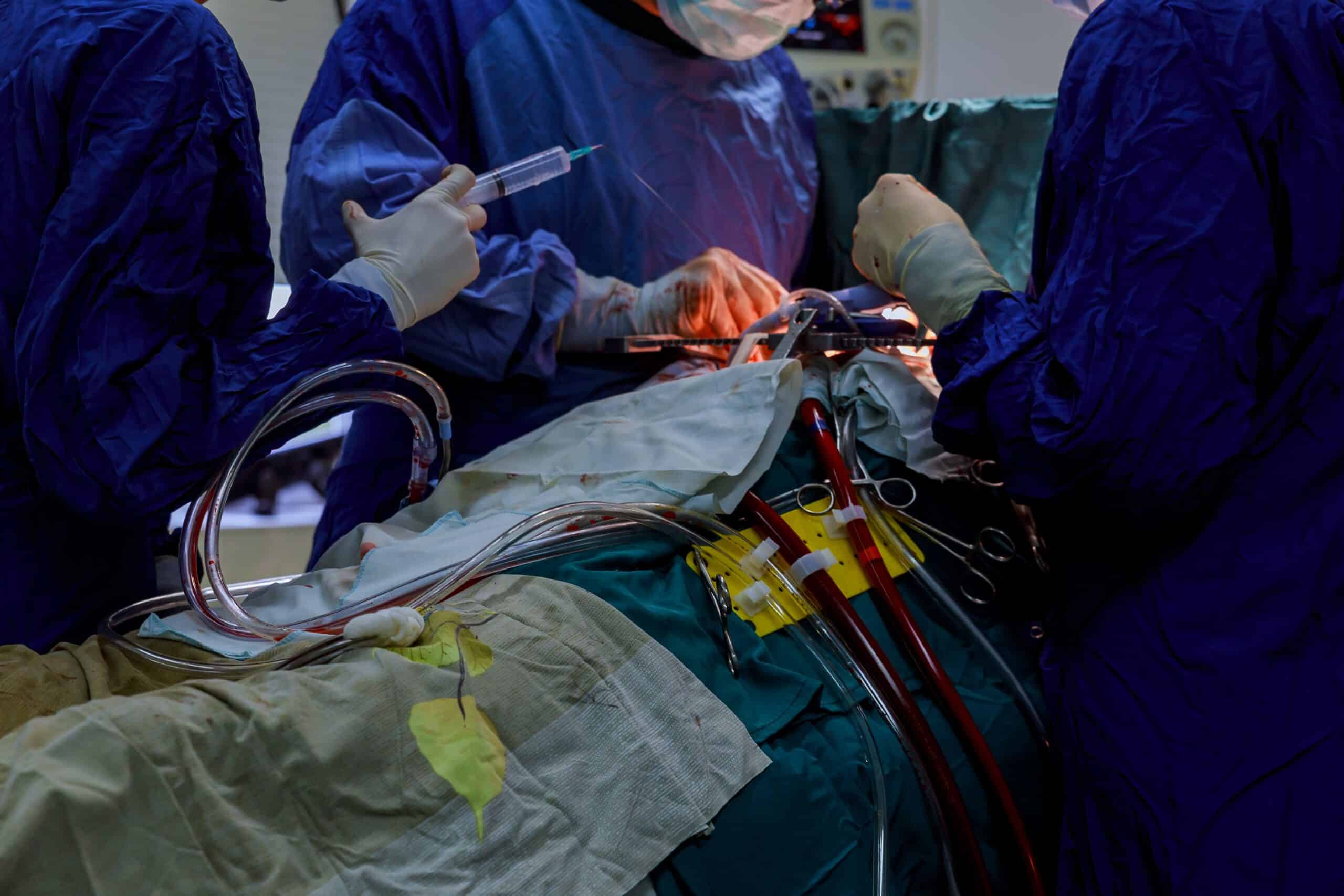 open-heart-cardiac-bypass-surgery-in-operation-roo-2022-11-12-10-56-21-utc-scaled.jpg